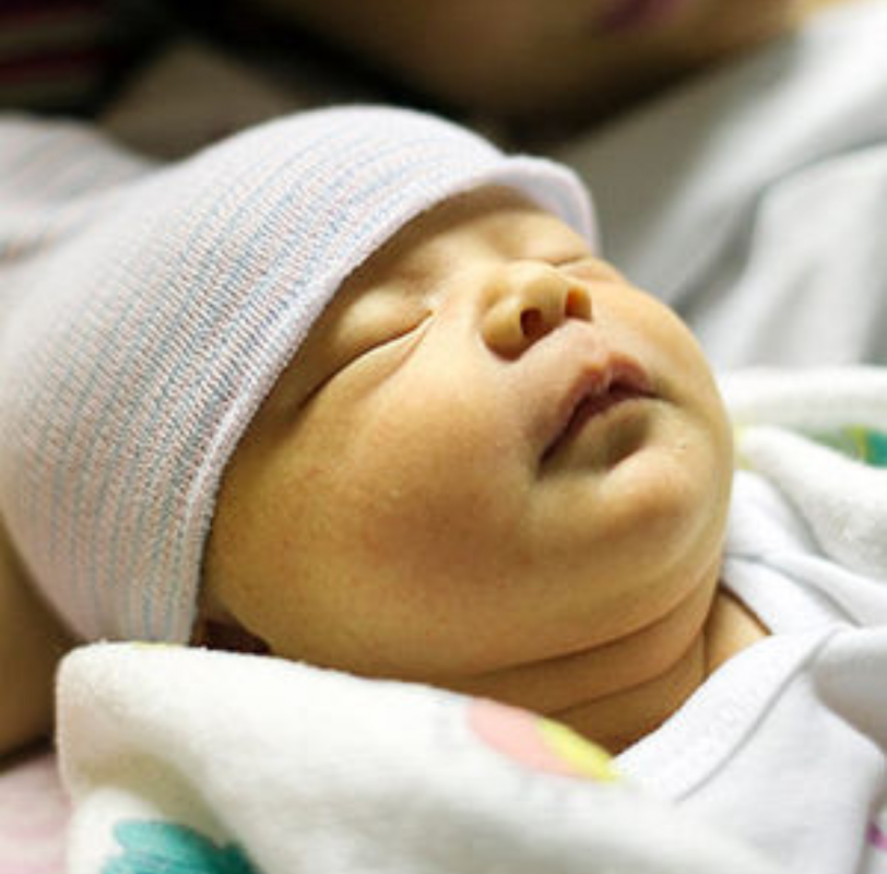 Prolonged Jaundice Pada Bayi : Ikterus Neonatorum : Dokter akan merujuk pasien (si bayi) untuk menjalani tes.